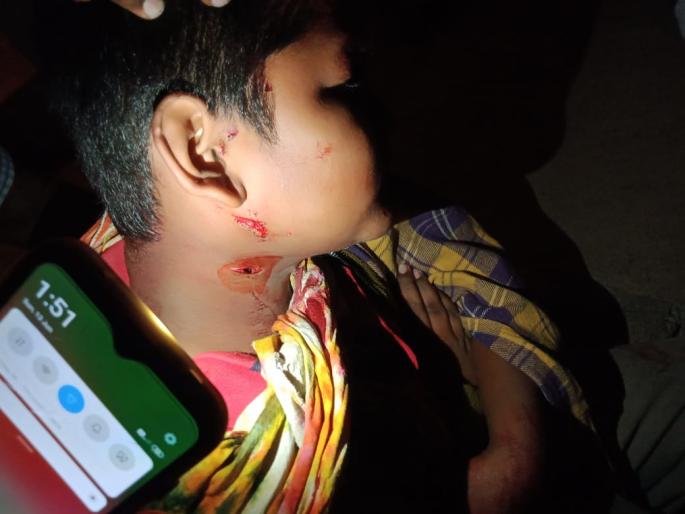 Ten seriously injured in wolf attack; Incidents in Mangalwedha taluka | लांडग्याच्या हल्ल्यात दहा जण गंभीर जखमी; मंगळवेढा तालुक्यातील घटना Ten seriously injured in wolf attack; Incidents in Mangalwedha taluka | लांडग्याच्या हल्ल्यात दहा जण गंभीर जखमी; मंगळवेढा तालुक्यातील घटना