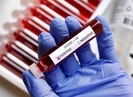 Corona virus Pune: 257 new corona patients and 284 corona patients recovered from corona in Pune on Thursday | Corona virus Pune : पुणे शहरात गुरुवारी २५७ नवे कोरोना रुग्ण तर २८४ जणांची कोरोनावर मात Corona virus Pune: 257 new corona patients and 284 corona patients recovered from corona in Pune on Thursday | Corona virus Pune : पुणे शहरात गुरुवारी २५७ नवे कोरोना रुग्ण तर २८४ जणांची कोरोनावर मात