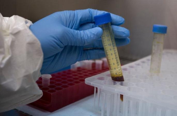 CoronaVirus: Mortality rate in Akola higher than in the state! | CoronaVirus : राज्याच्या तुलनेत अकोल्यातील मृत्युदर जास्त! CoronaVirus: Mortality rate in Akola higher than in the state! | CoronaVirus : राज्याच्या तुलनेत अकोल्यातील मृत्युदर जास्त!