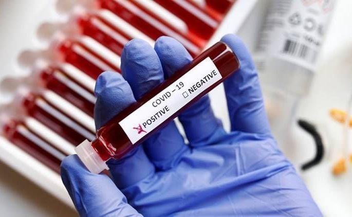 As the number of tests increased in Nagpur, so did the number of patients | CoronaVirus in Nagpur : नागपुरात चाचण्या वाढताच रुग्णसंख्येतही वाढ As the number of tests increased in Nagpur, so did the number of patients | CoronaVirus in Nagpur : नागपुरात चाचण्या वाढताच रुग्णसंख्येतही वाढ