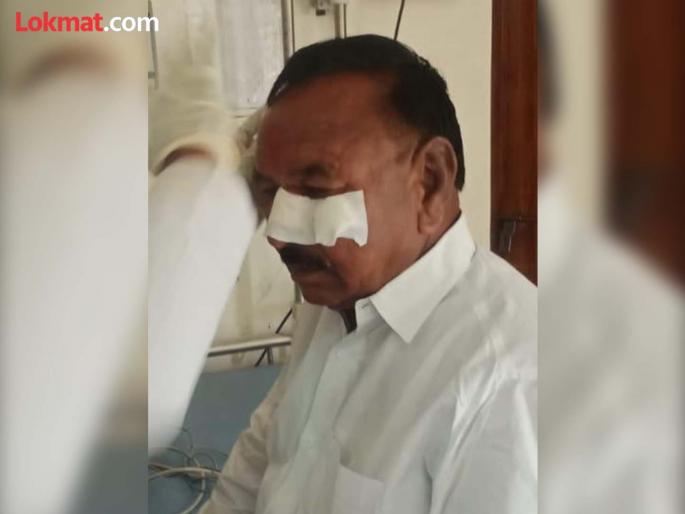 Voting in Indapur is cheeky; Riot in 2 factions of NCP, President of Tantamukti Samiti beaten up | इंदापूरात मतदानाला गालबोट; राष्ट्रवादीच्या २ गटात गदारोळ, तंटामुक्ती समितीच्या अध्यक्षास मारहाण Voting in Indapur is cheeky; Riot in 2 factions of NCP, President of Tantamukti Samiti beaten up | इंदापूरात मतदानाला गालबोट; राष्ट्रवादीच्या २ गटात गदारोळ, तंटामुक्ती समितीच्या अध्यक्षास मारहाण