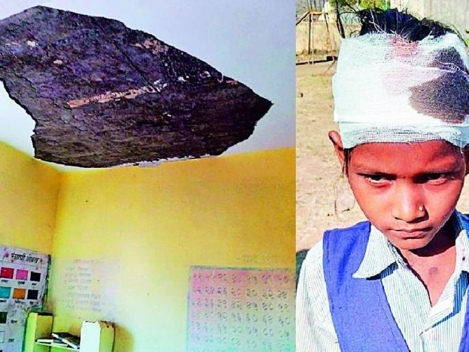 girl student injured in a accident after piece of the slab of school classroom collapsed | शाळेच्या वर्गखोलीचा तुकडा कोसळला, विद्यार्थिनी जखमी girl student injured in a accident after piece of the slab of school classroom collapsed | शाळेच्या वर्गखोलीचा तुकडा कोसळला, विद्यार्थिनी जखमी