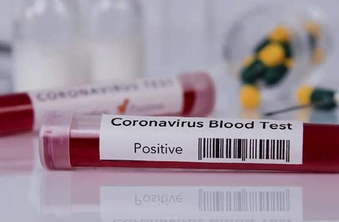 Dahegaon Mustafa and Bothali in a restricted village in Wardha district | वर्धा जिल्ह्यातील प्रतिबंधित गावात दहेगाव मुस्तफा आणि बोथलीची भर Dahegaon Mustafa and Bothali in a restricted village in Wardha district | वर्धा जिल्ह्यातील प्रतिबंधित गावात दहेगाव मुस्तफा आणि बोथलीची भर