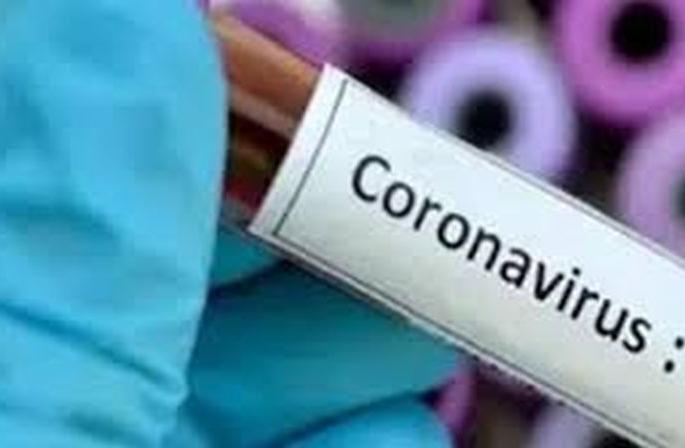 CoronaVirus in Khamgaon: Investigation of thousands of citizens from out-of-town is incomplete! | CoronaVirus in Khamgaon : बाहेरगावहून आलेल्या हजारावर नागरिकांची तपासणी अपूर्ण! CoronaVirus in Khamgaon: Investigation of thousands of citizens from out-of-town is incomplete! | CoronaVirus in Khamgaon : बाहेरगावहून आलेल्या हजारावर नागरिकांची तपासणी अपूर्ण!