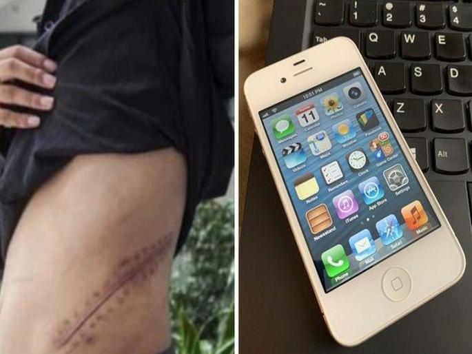 Boy Sold His Kidney For An iPhone 9 Yrs Ago He Continues To Be Bedridden For Life | आयफोनसाठी ९ वर्षांपूर्वी किडनी विकलेला 'तो' सध्या काय करतो?; वाचून धक्का बसेल Boy Sold His Kidney For An iPhone 9 Yrs Ago He Continues To Be Bedridden For Life | आयफोनसाठी ९ वर्षांपूर्वी किडनी विकलेला 'तो' सध्या काय करतो?; वाचून धक्का बसेल