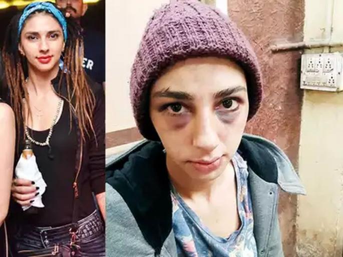 industrialists son arrested for abusing and beating iranian women | इराणी तरुणीचा महिनाभर घरात डांबून छळ; पुण्यात उद्योगपतीच्या मुलाला अटक industrialists son arrested for abusing and beating iranian women | इराणी तरुणीचा महिनाभर घरात डांबून छळ; पुण्यात उद्योगपतीच्या मुलाला अटक
