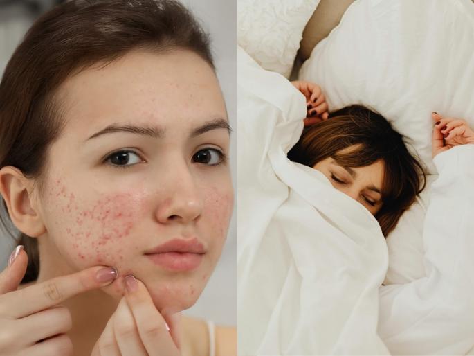 Is your dirty bedsheet causing pimples dirty bedding skin problems | महागड्या क्रीम्स, स्किनकेअर रूटीन फॉलो करूनही येतात पिंपल्स! 'हे' आहे कारणं - रोज झोपताना करता १ चूक...