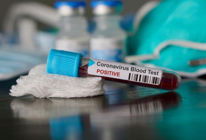 Positive patients in the subcontinent in contact with many | Corona Virus in Nagpur; उपराजधानीतील पॉझिटिव्ह रुग्ण अनेकांच्या संपर्कात Positive patients in the subcontinent in contact with many | Corona Virus in Nagpur; उपराजधानीतील पॉझिटिव्ह रुग्ण अनेकांच्या संपर्कात