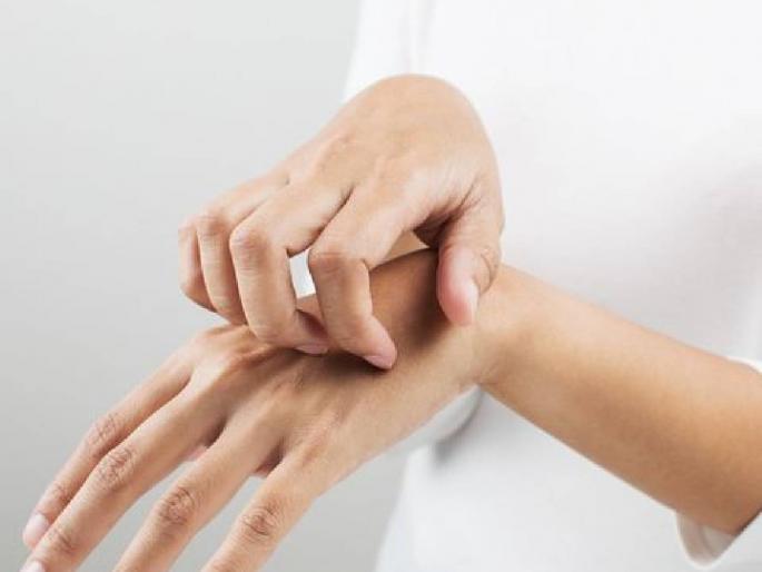 The body is itching, it can be a sign of serious illness | अंगाला खाज येतेय, गंभीर आजाराचे असू शकते लक्षण The body is itching, it can be a sign of serious illness | अंगाला खाज येतेय, गंभीर आजाराचे असू शकते लक्षण