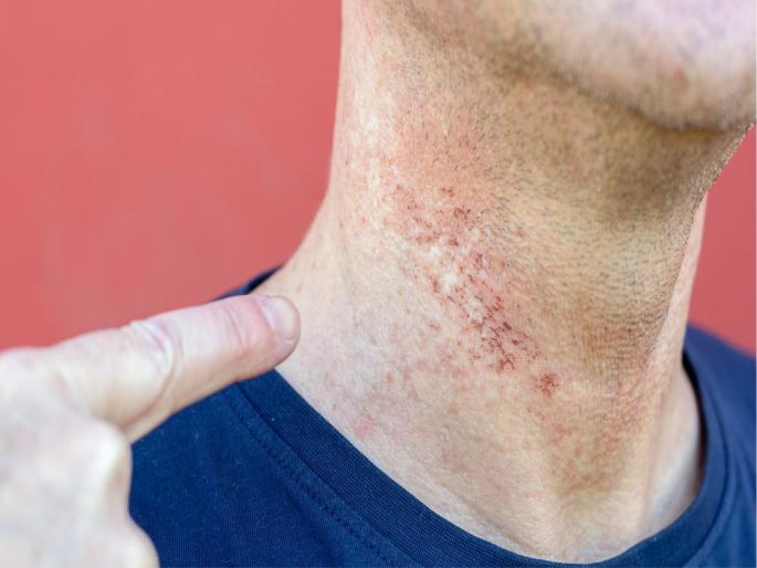 know the reasons of skin damage while shaving | तुमच्या 'या' चुकांमुळे शेविंग केल्यांवर होते जळजळ आणि स्कीन डॅमेज know the reasons of skin damage while shaving | तुमच्या 'या' चुकांमुळे शेविंग केल्यांवर होते जळजळ आणि स्कीन डॅमेज