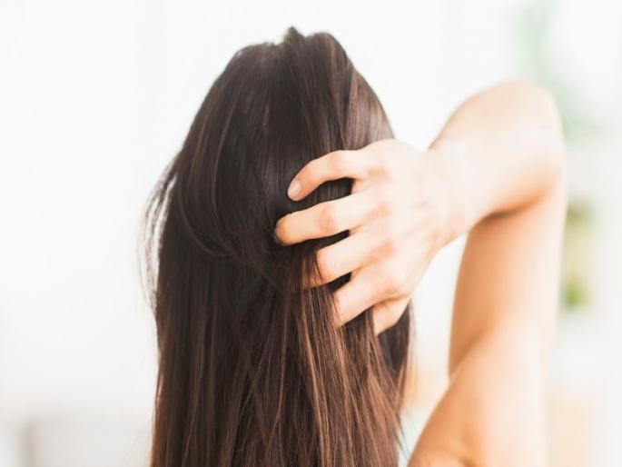 These are simple remedies for scalp itching and scalp infections | चारचौघात लाज आणते डोक्यातली खाज, डोक्याला झालेलं इन्फेक्शन बरं करणारे हे उपाय
