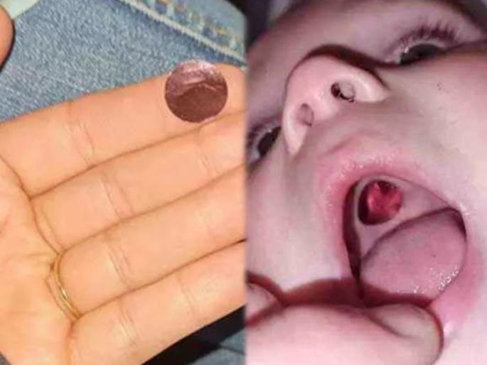 Mom take baby to hospital with hole in mouth but realise mistake nurse find it was a sticker | बापरे! मुलाच्या तोंडातलं छिद्र पाहून घाबरली आई; डॉक्टरांनी लक्षात आणून दिली मोठी चूक Mom take baby to hospital with hole in mouth but realise mistake nurse find it was a sticker | बापरे! मुलाच्या तोंडातलं छिद्र पाहून घाबरली आई; डॉक्टरांनी लक्षात आणून दिली मोठी चूक
