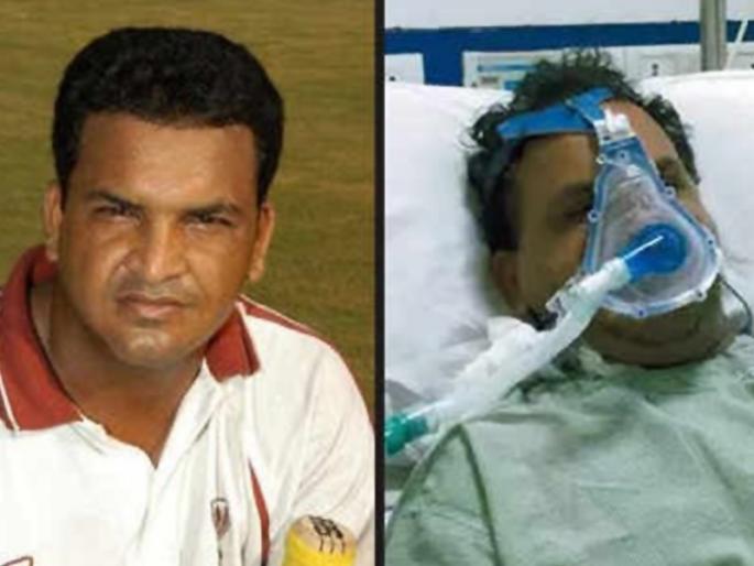 Krunal Pandya shows great gesture towards ailing former cricketer Jacob Martin | पांड्याची 'लाख'मोलाची मदत; व्हेंटिलेटरवरील मार्टिन यांच्या उपचाराच्या खर्चाचा भार उचलला