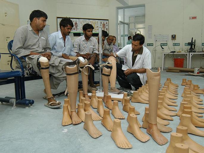 free Jaipur Foot Camp on 11th june | दिव्यांगांना कृत्रिम अवयवांचे बळ; ११ जूनला मोफत जयपूर फूट शिबिर free Jaipur Foot Camp on 11th june | दिव्यांगांना कृत्रिम अवयवांचे बळ; ११ जूनला मोफत जयपूर फूट शिबिर