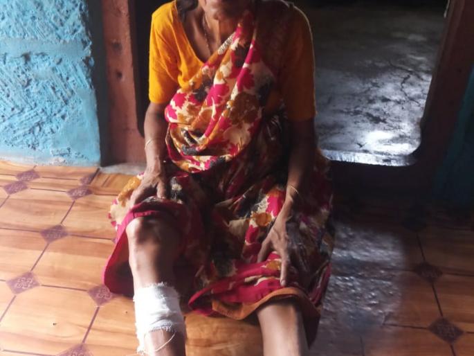 Bite the villagers in Rajapur with a fox | राजापुरात पिसाळलेल्या कोल्ह्याने घेतला ग्रामस्थांना चावा Bite the villagers in Rajapur with a fox | राजापुरात पिसाळलेल्या कोल्ह्याने घेतला ग्रामस्थांना चावा