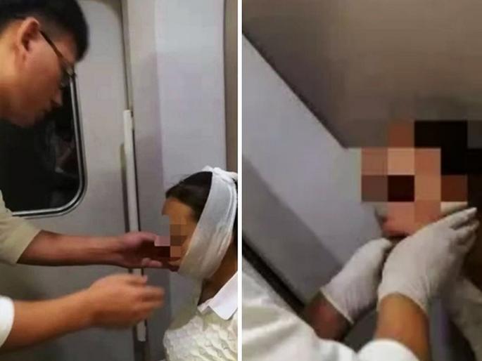 Chinese woman laughed so hard that her mouth got stuck jaw dislocated | 'ती' इतक्या जोरात हसली की तोंडच बंद होईना, डॉक्टरही तिला पाहून झाले होते हैराण... Chinese woman laughed so hard that her mouth got stuck jaw dislocated | 'ती' इतक्या जोरात हसली की तोंडच बंद होईना, डॉक्टरही तिला पाहून झाले होते हैराण...