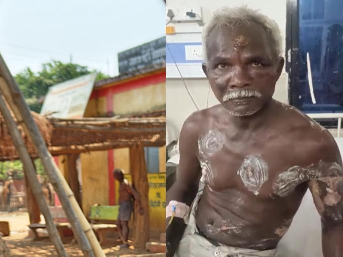 An old man was flogged with a hot rod on suspicion of witchcraft; Inhuman events in Zambia | जादूटाेण्याच्या संशयावरून वृद्धाला गरम सळईचे चटके; जांभियातील अमानुष घटना An old man was flogged with a hot rod on suspicion of witchcraft; Inhuman events in Zambia | जादूटाेण्याच्या संशयावरून वृद्धाला गरम सळईचे चटके; जांभियातील अमानुष घटना