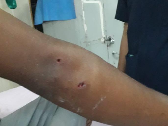 Youth injured in leopard attack; Incidents in Igatpuri taluka in Nashik | बिबट्याच्या हल्ल्यात युवक जखमी; नाशिकमधील इगतपुरी तालुक्यातील घटना Youth injured in leopard attack; Incidents in Igatpuri taluka in Nashik | बिबट्याच्या हल्ल्यात युवक जखमी; नाशिकमधील इगतपुरी तालुक्यातील घटना