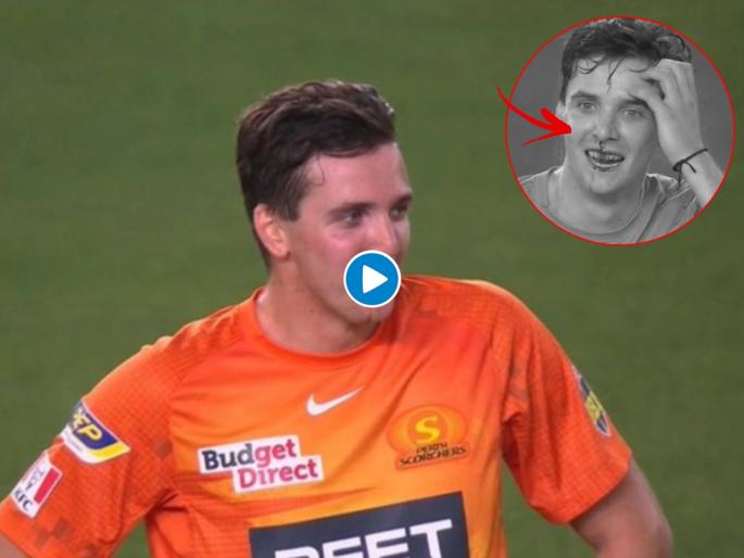 BBL Final: Jhye Richardson left with bleeding nose during Perth Scorchers' title-winning celebrations, Video | BBL Final: विजयाचं भयानक सेलिब्रेशन; Perth Scorchersच्या खेळाडूच्या नाकातून वाहू लागले रक्त अन्... Video 