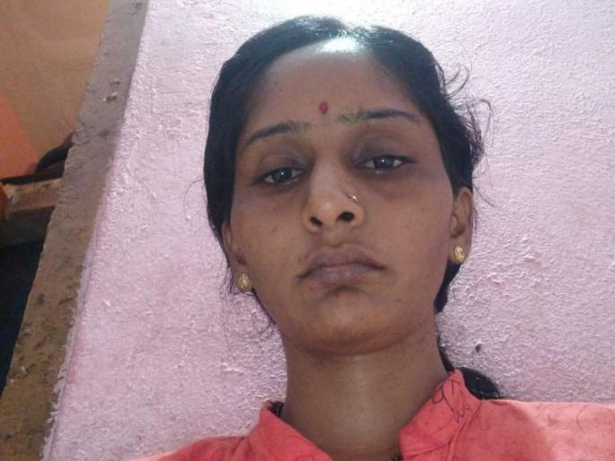 The trachea was broken, the voice was lost, but the civil doctor rebirth ujwala khot in sangli | श्वासनलिका तुटली, आवाजही गेला, पण सिव्हिलच्या डॉक्टरांनी पुनर्जन्म दिला The trachea was broken, the voice was lost, but the civil doctor rebirth ujwala khot in sangli | श्वासनलिका तुटली, आवाजही गेला, पण सिव्हिलच्या डॉक्टरांनी पुनर्जन्म दिला