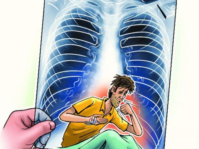 Make a single decision, don't want tuberculosis in life | करा एकच निर्धार, आयुष्यात नको क्षयाचा आजार Make a single decision, don't want tuberculosis in life | करा एकच निर्धार, आयुष्यात नको क्षयाचा आजार