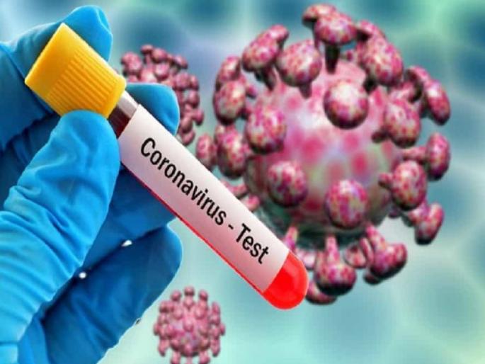 Coronavirus study confirms sperm containing virus raises risk of covid 19 spread via sex myb | CoronaVirus News : शारीरिक संबंधांमुळे कोरोना होण्याची भीती; स्पर्म्समध्ये सापडला विषाणू Coronavirus study confirms sperm containing virus raises risk of covid 19 spread via sex myb | CoronaVirus News : शारीरिक संबंधांमुळे कोरोना होण्याची भीती; स्पर्म्समध्ये सापडला विषाणू