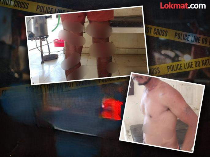 After Sonu Daud, two more arrested in kailas Borade assault and burn case | युवकाला चटके दिल्याप्रकरणात सोनू दौड याच्यानंतर आणखी दोघे जेरबंद After Sonu Daud, two more arrested in kailas Borade assault and burn case | युवकाला चटके दिल्याप्रकरणात सोनू दौड याच्यानंतर आणखी दोघे जेरबंद