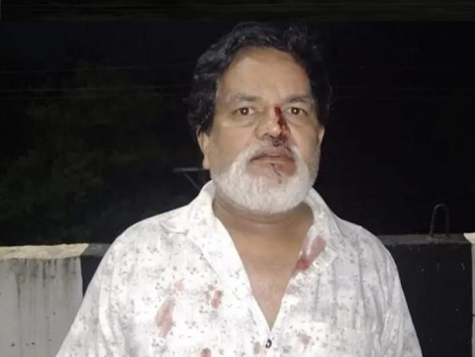 Attack on a businessman at Kasarde on the Mumbai Goa highway | Crime News sindhudurg: मॉर्निंग वॉकला गेलेल्या व्यावसायिकावर प्राणघातक हल्ला, कासार्डे येथील घटना Attack on a businessman at Kasarde on the Mumbai Goa highway | Crime News sindhudurg: मॉर्निंग वॉकला गेलेल्या व्यावसायिकावर प्राणघातक हल्ला, कासार्डे येथील घटना