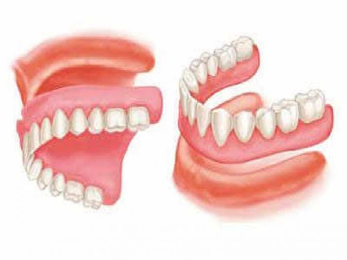 Cavity removed from the womb | वृद्धाच्या पोटातून काढली कवळी Cavity removed from the womb | वृद्धाच्या पोटातून काढली कवळी