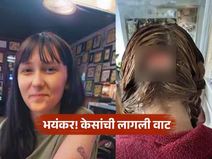 She Went For Golden Hair But Ended Up With A Burnt Scalp And A Bald Patch | केस कलर करण्याची हौस बेतली जीवावर; तरुणीसोबत घडलं भयंकर, अवस्था पाहून बसेल धक्का