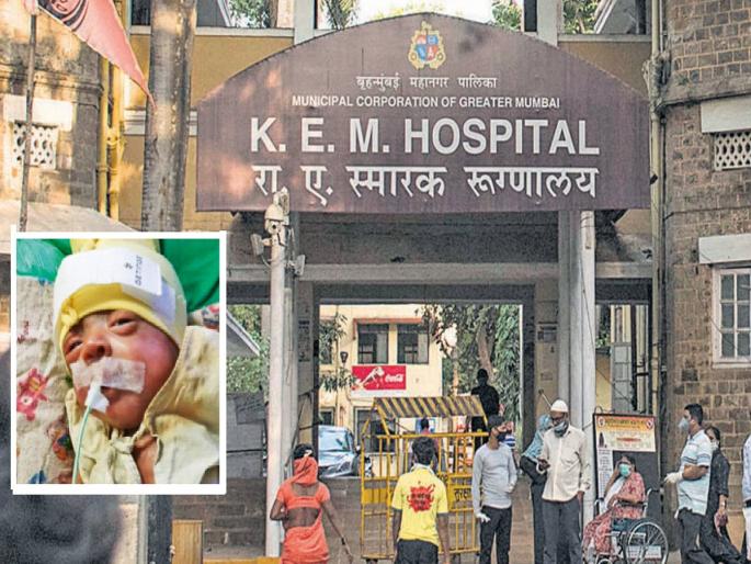 The hand of the baby is gone, no one has a hand in it..? A worried father's question | बाळाचा हात गेला, त्यात कोणाचाही हात नाही..? उद्विग्न बापाचा सवाल The hand of the baby is gone, no one has a hand in it..? A worried father's question | बाळाचा हात गेला, त्यात कोणाचाही हात नाही..? उद्विग्न बापाचा सवाल