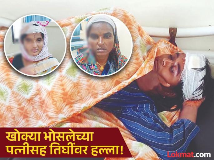 'Tumhi Lay Majalat'; Armed attack on Khokya Bhosale's house; Three people including his wife seriously injured! | 'तुम्ही लय माजलात'; खोक्या भोसलेच्या घरावर सशस्त्र हल्ला; पत्नीसह तिघी गंभीर जखमी!