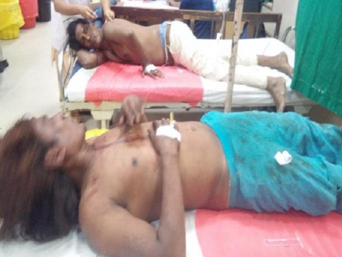 one folk artist dies while treatment in progress; people punishes him supposing kidnappers | मुले पळविणारे समजून बेदम मारहाण झालेल्या बहुरुप्याचा उपचारा दरम्यान मृत्यू one folk artist dies while treatment in progress; people punishes him supposing kidnappers | मुले पळविणारे समजून बेदम मारहाण झालेल्या बहुरुप्याचा उपचारा दरम्यान मृत्यू