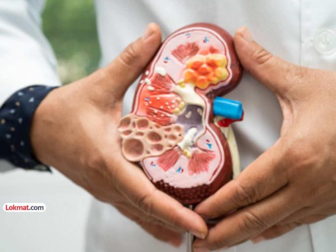 Back pain blood in urine Could it be kidney cancer Take the seriousness into account in time | पाठ दुखतेय, लघवीतून रक्त पडतंय; मूत्रपिंडाचा कर्करोग तर नाही? वेळीच गांभीर्य लक्षात घ्या