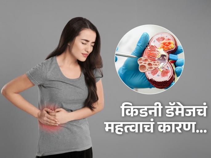 High protein diet can damage your kidneys says study | जास्त प्रमाणात प्रोटीन घेणं घातक, किडनी होऊ शकते डॅमेज; पाहा कुणाला असतो जास्त धोका