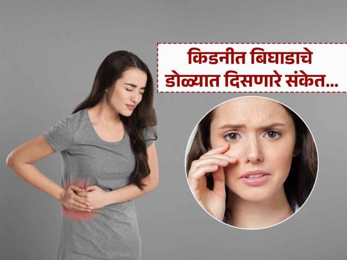 Warning signs of kidney damage in eyes | डोळ्यात दिसतात किडनीमध्ये बिघाड झाल्याचे काही संकेत, वेळीच ओळखाल तर टळेल मोठा धोका Warning signs of kidney damage in eyes | डोळ्यात दिसतात किडनीमध्ये बिघाड झाल्याचे काही संकेत, वेळीच ओळखाल तर टळेल मोठा धोका