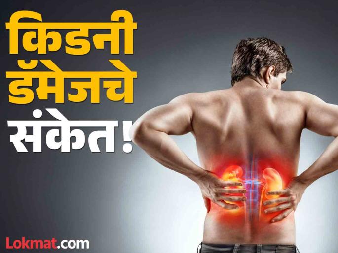 Kidney disease symptoms : These symptoms seen at night indicate kidney damage | किडनी डॅमेज होत असेल तर रात्री दिसतात ही लक्षणं, दुर्लक्ष कराल तर पडू शकतं महागात!