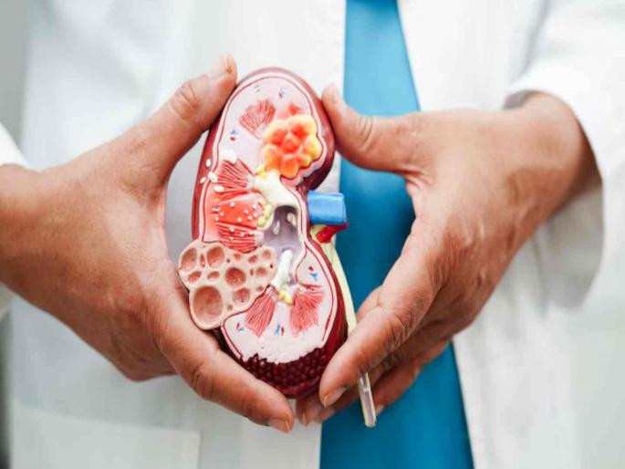 Increase in kidney disease patients in Maharashtra Dialysis or transplant is the only option | महाराष्ट्रात मूत्रपिंड विकारांच्या रुग्णांत वाढ; डायलिसिस किंवा प्रत्यारोपण हाच पर्याय Increase in kidney disease patients in Maharashtra Dialysis or transplant is the only option | महाराष्ट्रात मूत्रपिंड विकारांच्या रुग्णांत वाढ; डायलिसिस किंवा प्रत्यारोपण हाच पर्याय