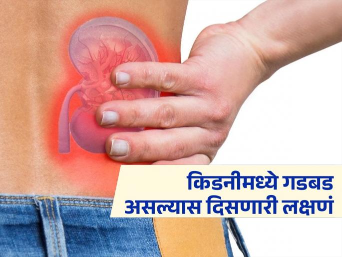 Symptoms of kidney problem appear in the morning | किडनीत काही गडबड असल्यास सकाळी दिसतात 'ही' लक्षणं, दिसताच तर वेळीच व्हा सावध...