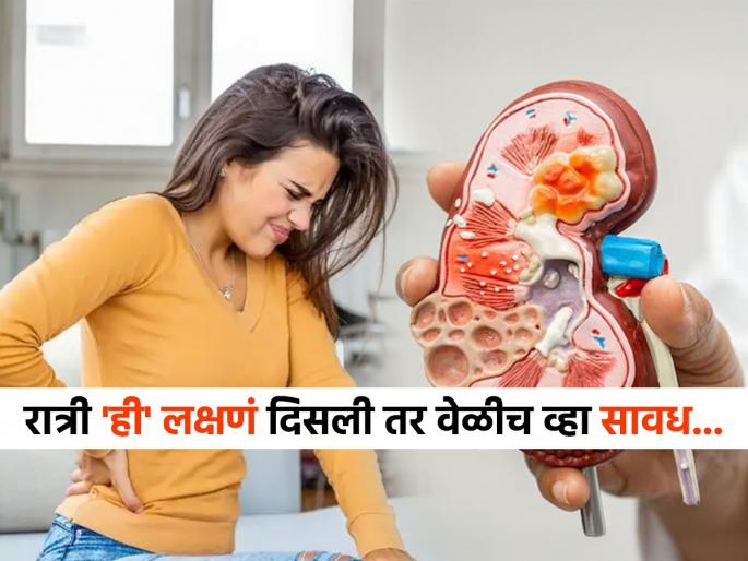 Symptoms seen at night sign of kidney damage | किडनीमध्ये काही गडबड असेल रात्री शरीरात दिसतात 'ही' लक्षणं, उशीर होण्याआधी घ्या योग्य उपचार