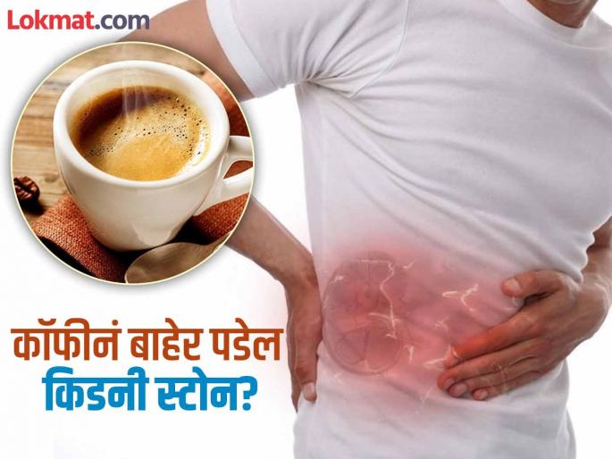 Coffee can remove kidney stone from body know right way to drink it | छोटे छोटे स्टोन बाहेर काढण्यासाठी कॉफी पिण्याची योग्य पद्धत, फक्त एक चूक पडेल महागात! Coffee can remove kidney stone from body know right way to drink it | छोटे छोटे स्टोन बाहेर काढण्यासाठी कॉफी पिण्याची योग्य पद्धत, फक्त एक चूक पडेल महागात!