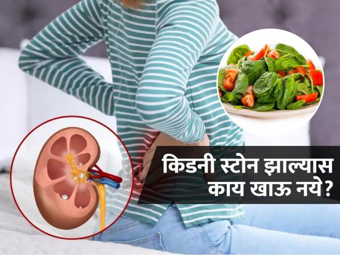 If you have kidney stones avoid the combination of spinach and tomatoes, know why | किडनी स्टोन झाल्यास पालक आणि टोमॅटो एकत्र खाणं घातक,आहारतज्ज्ञ सांगतात एक महत्वाचा नियम