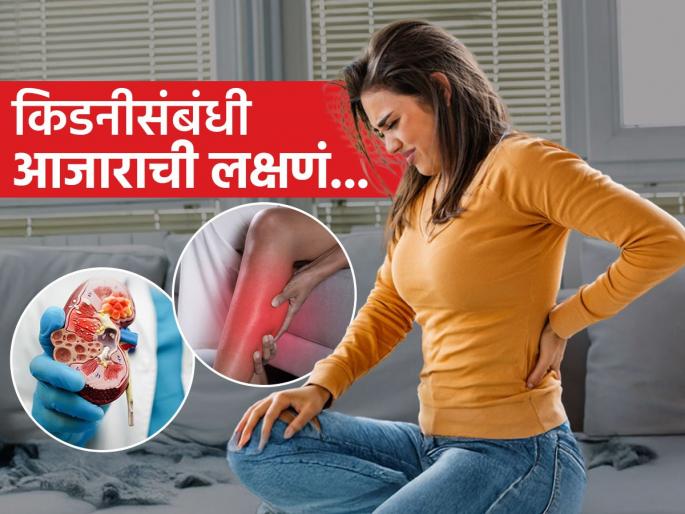 What are the kidney stone signs and its risk factors | पाय आणि कंबरेच्या दुखण्याला सामान्य समजता? किडनीच्या 'या' आजाराचे असू शकतात संकेत