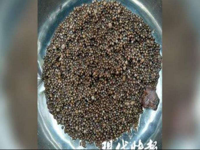 Women complained of back pain, doctors found almost 3000 kidney stones | बापरे! पाठदुखीची तक्रार घेऊन आलेल्या महिलेच्या पोटातून काढले 3000 मुतखडे Women complained of back pain, doctors found almost 3000 kidney stones | बापरे! पाठदुखीची तक्रार घेऊन आलेल्या महिलेच्या पोटातून काढले 3000 मुतखडे