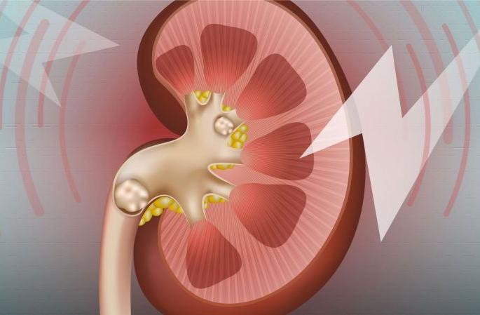 Risk of 'Kidney Stone' due to increase in screen time! | स्क्रीन टाइम वाढल्याने ‘किडनी स्टोन’चा धोका! Risk of 'Kidney Stone' due to increase in screen time! | स्क्रीन टाइम वाढल्याने ‘किडनी स्टोन’चा धोका!