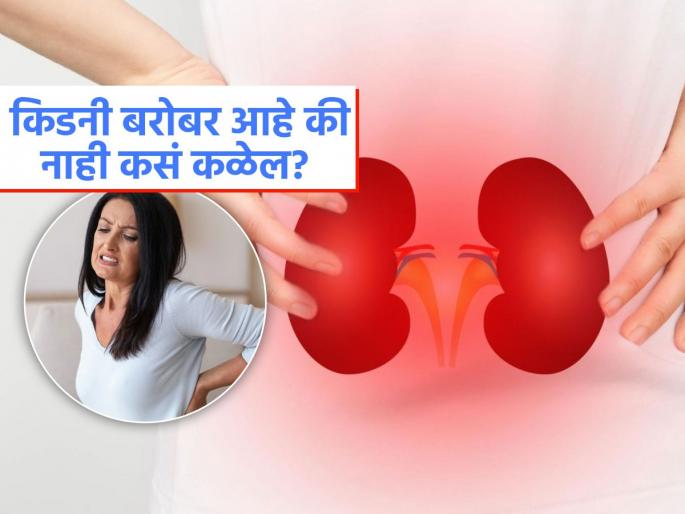 How do I check my kidneys are working okay know the about easy kidney test | किडनी बरोबर काम करत आहेत की नाही कसं कळेल? पाहा 'या' आहेत काही सोप्या पद्धती How do I check my kidneys are working okay know the about easy kidney test | किडनी बरोबर काम करत आहेत की नाही कसं कळेल? पाहा 'या' आहेत काही सोप्या पद्धती