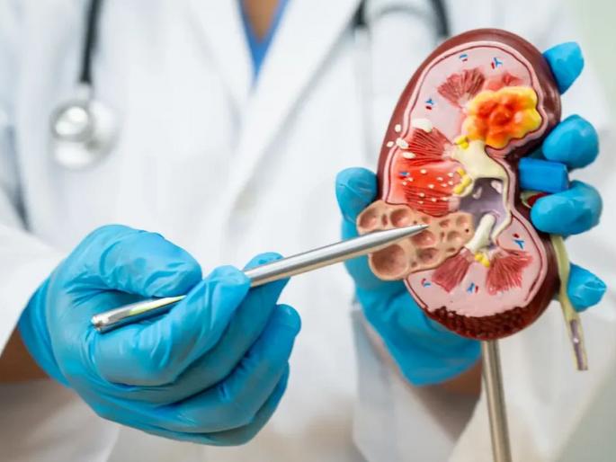 Big success! Scientists have created a 'universal kidney'; Can be transplanted regardless of the patient's blood group | मोठे यश! शास्त्रज्ञांनी बनवली 'युनिव्हर्सल किडनी'; रुग्णाचा कोणताही रक्तगट असुदे, प्रत्यारोपण करता येणार Big success! Scientists have created a 'universal kidney'; Can be transplanted regardless of the patient's blood group | मोठे यश! शास्त्रज्ञांनी बनवली 'युनिव्हर्सल किडनी'; रुग्णाचा कोणताही रक्तगट असुदे, प्रत्यारोपण करता येणार