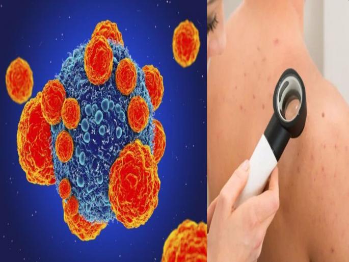 Health News Marathi : iisc develops bandage that can kill skin cancer cells | खुशखबर! कॅन्सरच्या उपचारांसाठी भारतीय वैज्ञानिकांनी तयार केलं अनोखं 'बँडेज', तज्ज्ञांचा दावा