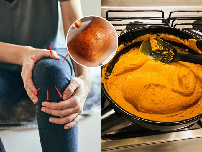 Natural ways to reduce knee pain Knee pain home remedies Remedies for joint sound in knees Knee pain treatment at home naturally | गुडघेदुखीचा त्रास-सांध्यांतून कट-कट आवाज येतो? डॉक्टर सांगतात ५ उपाय - दुखणे होईल कमी...