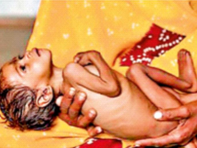 Death of 65 children due to malnutrition is a terrible thing; we should be concerned! | कुपोषणाने ६५ बालकांचा मृत्यू हा भयंकर प्रकार; चिंता करावी! कोर्ट म्हणाले, पण तुम्ही तर अत्यंत बेजबाबदार